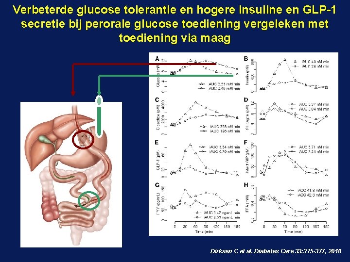 Verbeterde glucose tolerantie en hogere insuline en GLP-1 secretie bij perorale glucose toediening vergeleken