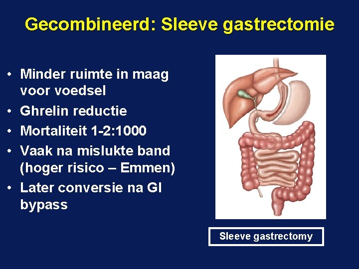 Gecombineerd: Sleeve gastrectomie • Minder ruimte in maag voor voedsel • Ghrelin reductie •