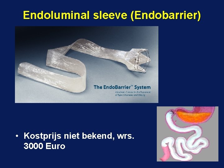 Endoluminal sleeve (Endobarrier) • Kostprijs niet bekend, wrs. 3000 Euro 