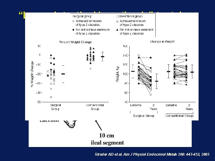 “Lower intestinal hypothesis” toetsing: Transpositie van ileum segment Strader AD et al. Am J