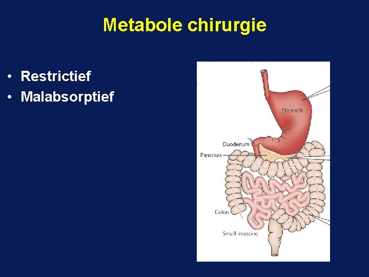 Metabole chirurgie • Restrictief • Malabsorptief 