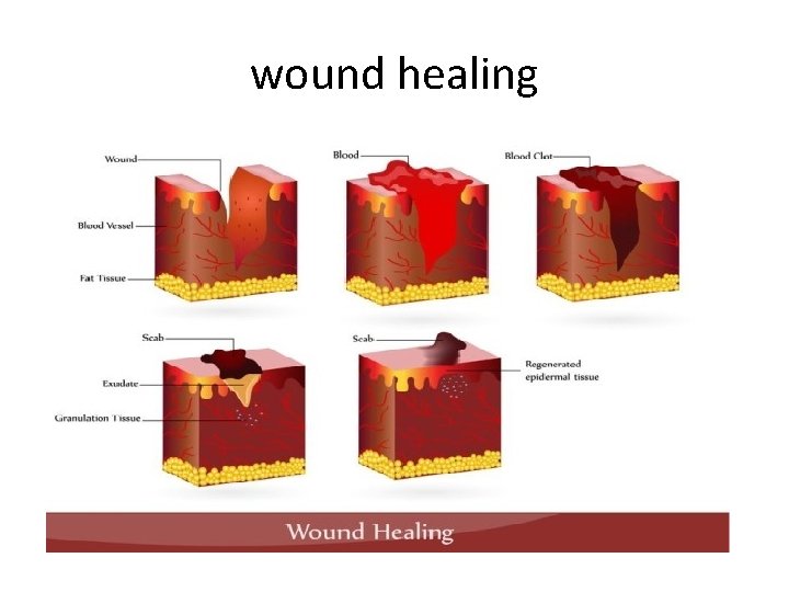 wound healing 