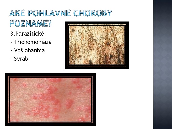 3. Parazitické: - Trichomoniáza - Voš ohanbia - Svrab 