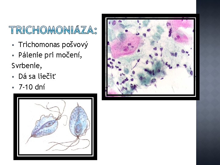 Trichomonas pošvový § Pálenie pri močení, Svrbenie, § Dá sa liečiť § 7 -10