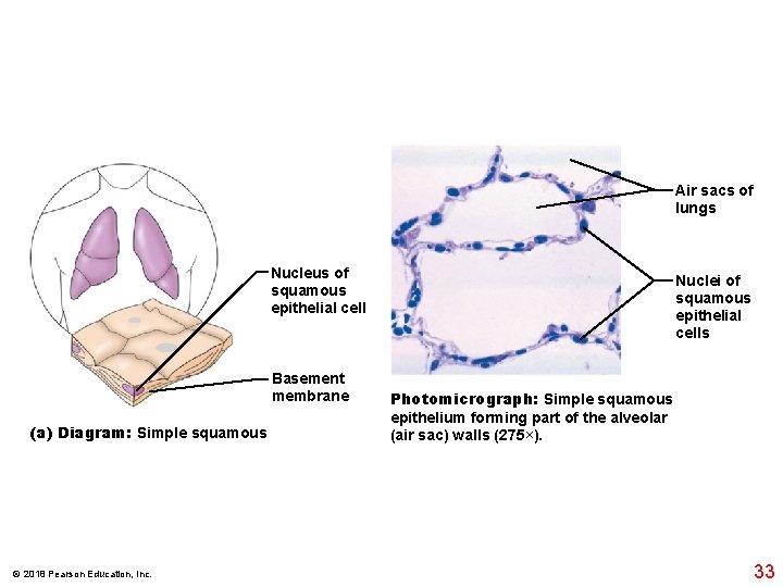 Air sacs of lungs Nucleus of squamous epithelial cell Basement membrane (a) Diagram: Simple