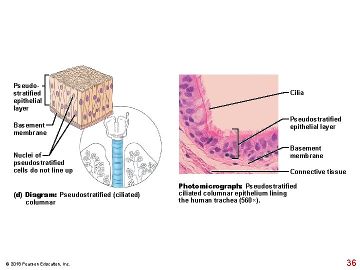 Pseudostratified epithelial layer Basement membrane Nuclei of pseudostratified cells do not line up (d)