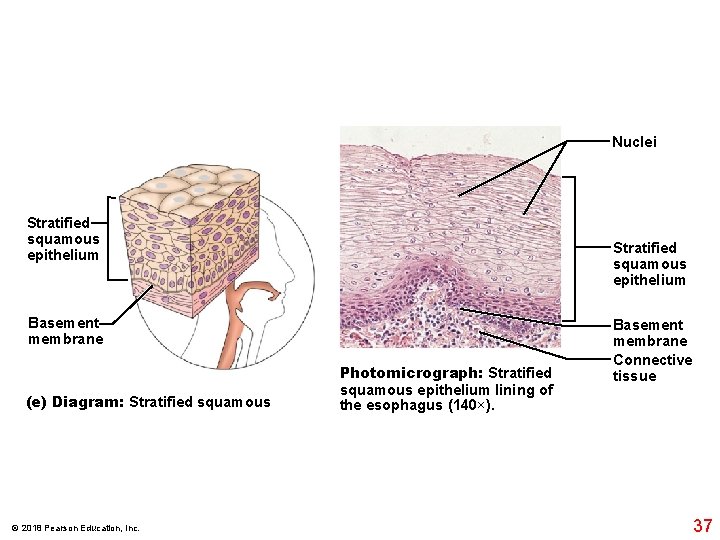 Nuclei Stratified squamous epithelium Basement membrane (e) Diagram: Stratified squamous © 2018 Pearson Education,