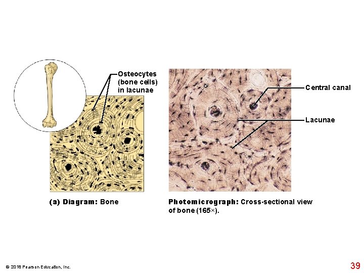 Osteocytes (bone cells) in lacunae Central canal Lacunae (a) Diagram: Bone © 2018 Pearson