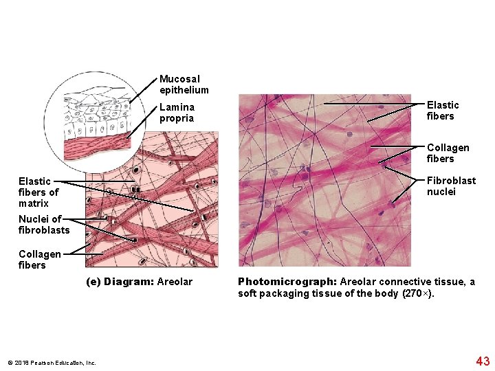 Mucosal epithelium Lamina propria Elastic fibers Collagen fibers Fibroblast nuclei Elastic fibers of matrix