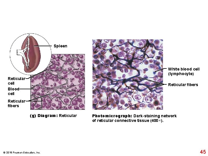 Spleen White blood cell (lymphocyte) Reticular cell Blood cell Reticular fibers (g) Diagram: Reticular