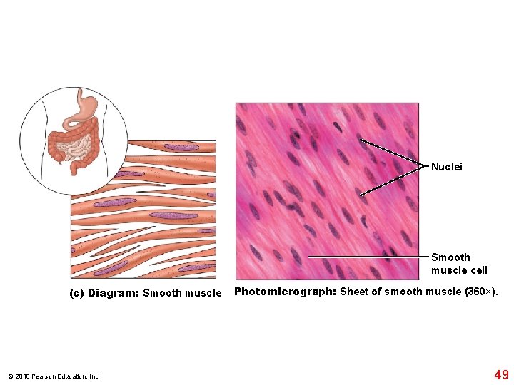 Nuclei Smooth muscle cell (c) Diagram: Smooth muscle © 2018 Pearson Education, Inc. Photomicrograph: