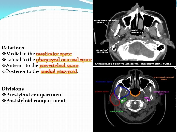 Relations v. Medial to the masticator space. v. Lateral to the pharyngeal mucosal space.