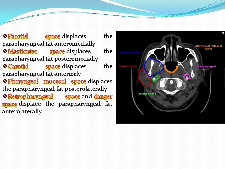 v. Parotid space displaces the parapharyngeal fat anteromedially v. Masticator space displaces the parapharyngeal