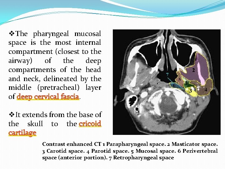 v. The pharyngeal mucosal space is the most internal compartment (closest to the airway)