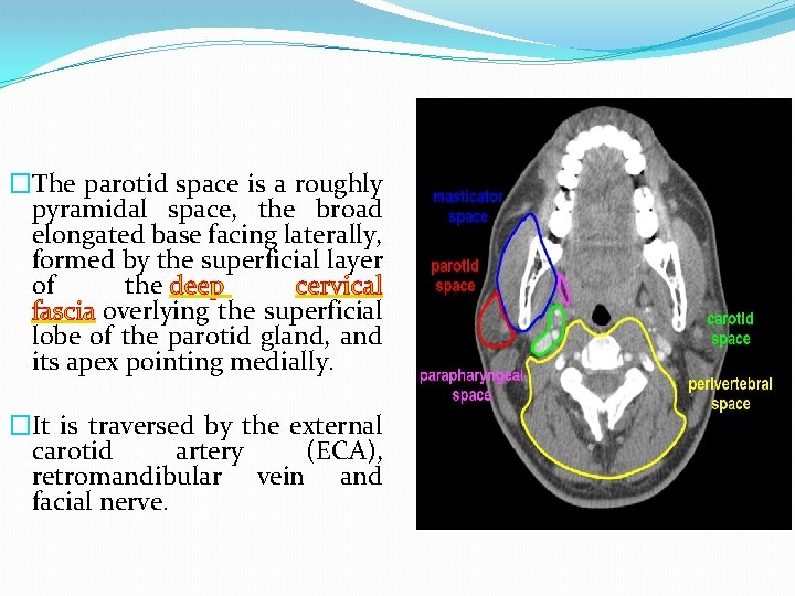�The parotid space is a roughly pyramidal space, the broad elongated base facing laterally,