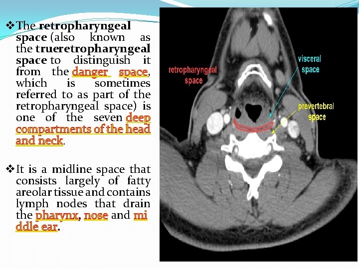 v The retropharyngeal space (also known as the true retropharyngeal space to distinguish it