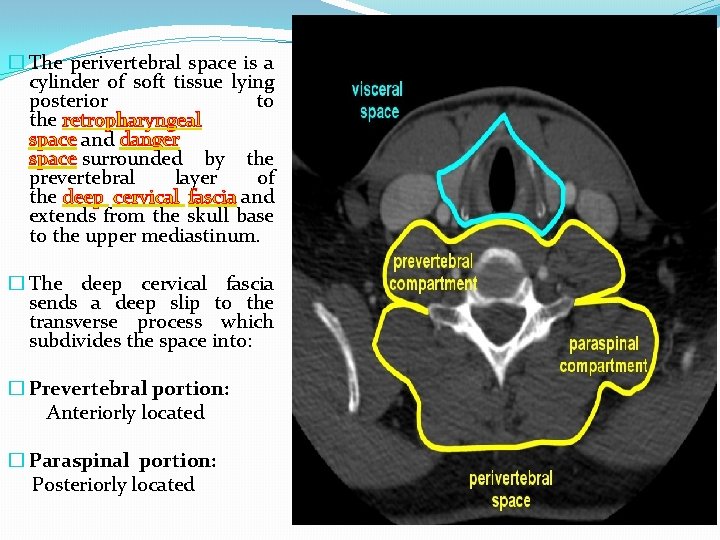 � The perivertebral space is a cylinder of soft tissue lying posterior to the