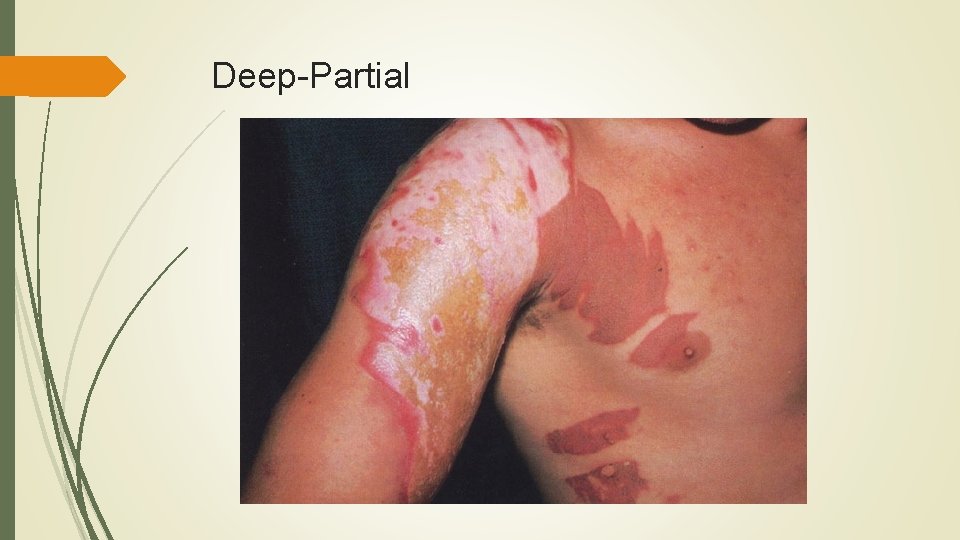 Deep-Partial 