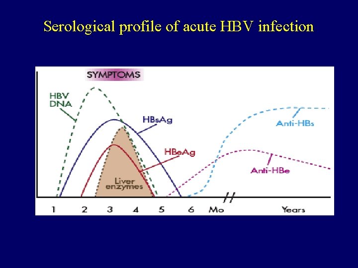 Serological profile of acute HBV infection 