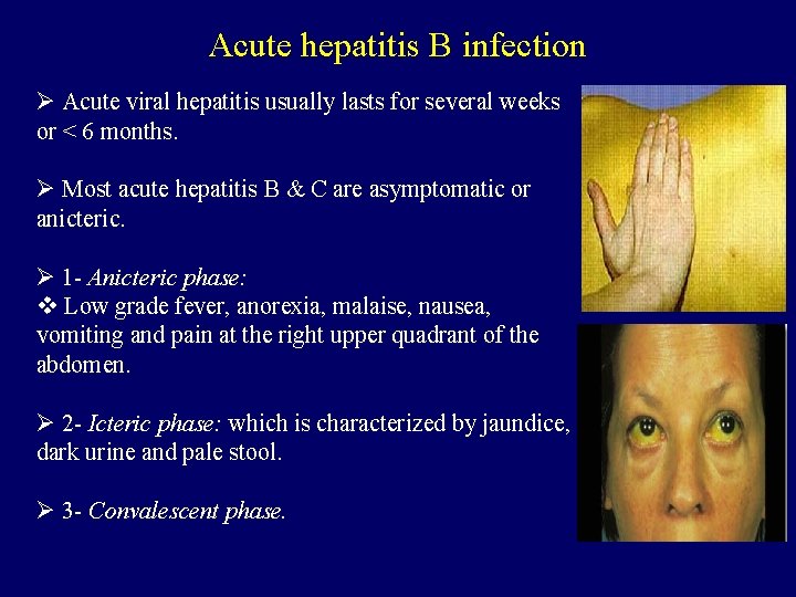 Acute hepatitis B infection Ø Acute viral hepatitis usually lasts for several weeks or