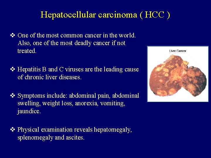 Hepatocellular carcinoma ( HCC ) v One of the most common cancer in the