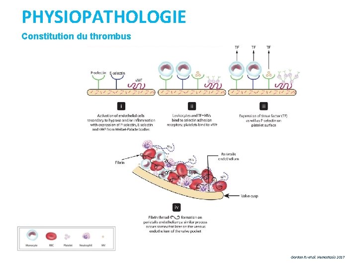 PHYSIOPATHOLOGIE Constitution du thrombus Gordon RJ et al. Hemostasis 2017 