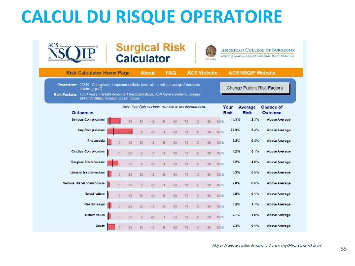 CALCUL DU RISQUE OPERATOIRE https: //www. riskcalculator. facs. org/Risk. Calculator/ 55 