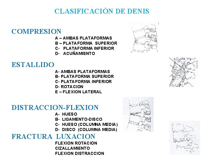 CLASIFICACIÓN DE DENIS COMPRESION A – AMBAS PLATAFORMAS B – PLATAFORMA SUPERIOR C- PLATAFORMA
