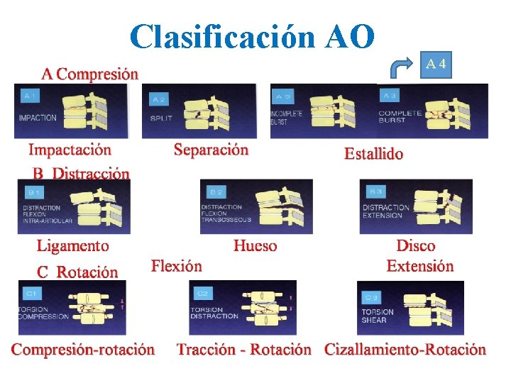 Clasificación AO A 4 
