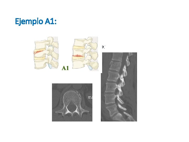 Ejemplo A 1: 