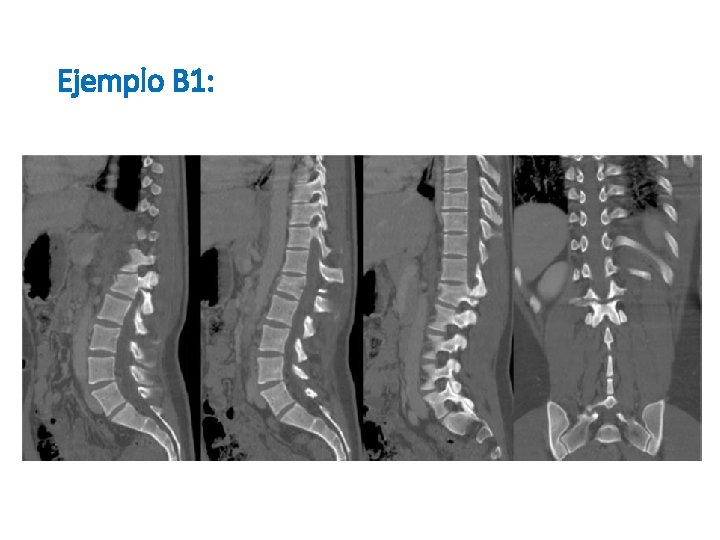 Ejemplo B 1: 