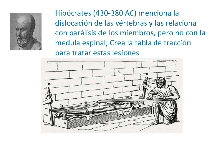 Hipócrates (430 -380 AC) menciona la dislocación de las vértebras y las relaciona con