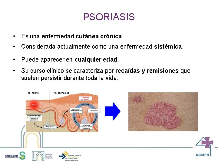 PSORIASIS • Es una enfermedad cutánea crónica. • Considerada actualmente como una enfermedad sistémica.