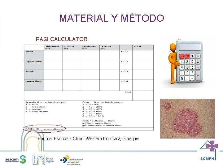 MATERIAL Y MÉTODO PASI CALCULATOR Source: Psoriasis Clinic, Western Infirmary, Glasgow 