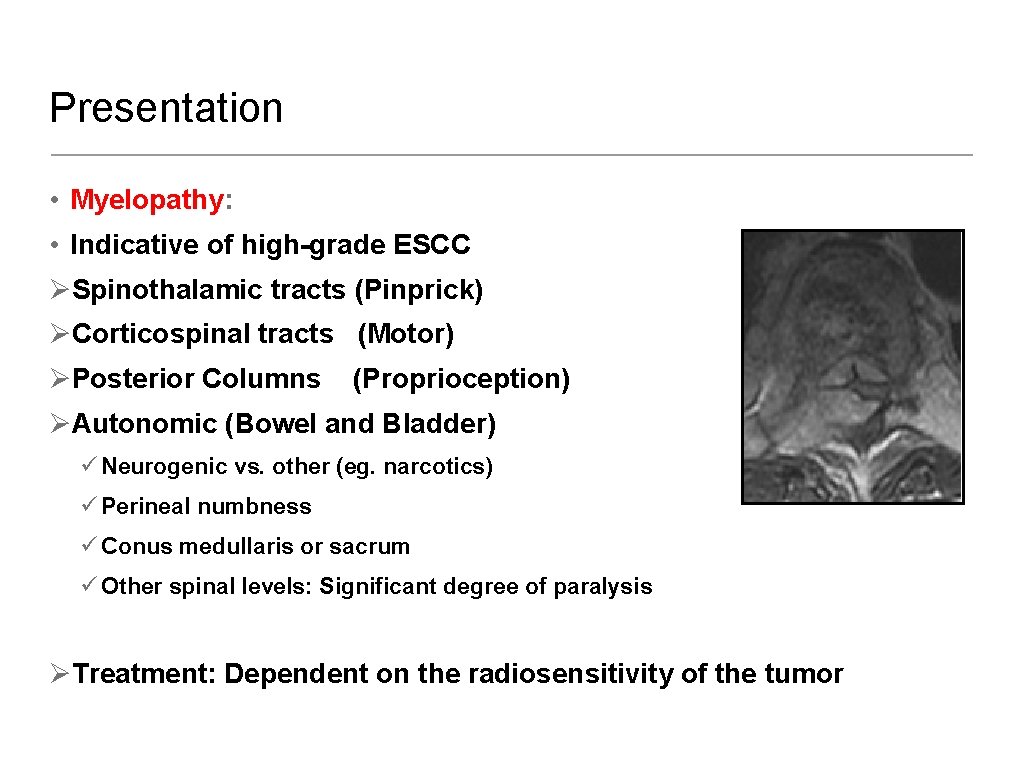 Presentation • Myelopathy: • Indicative of high-grade ESCC ØSpinothalamic tracts (Pinprick) ØCorticospinal tracts (Motor)