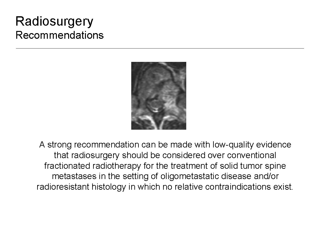 Radiosurgery Recommendations A strong recommendation can be made with low-quality evidence that radiosurgery should