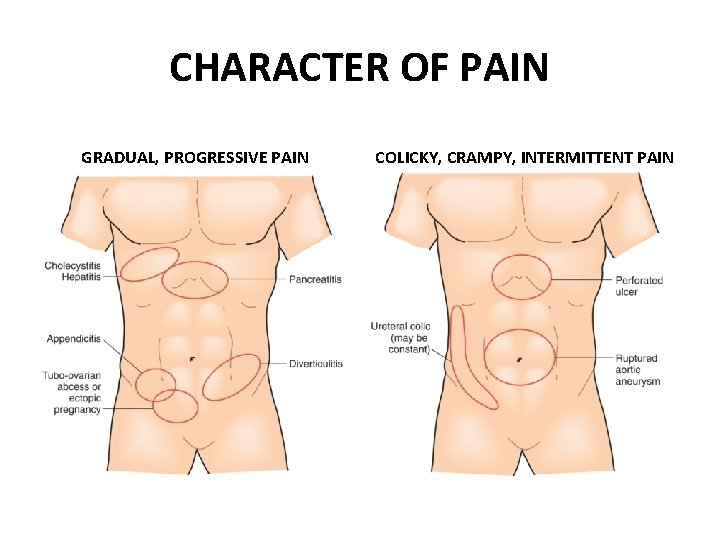 CHARACTER OF PAIN GRADUAL, PROGRESSIVE PAIN COLICKY, CRAMPY, INTERMITTENT PAIN 