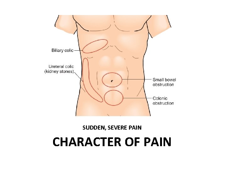 SUDDEN, SEVERE PAIN CHARACTER OF PAIN 