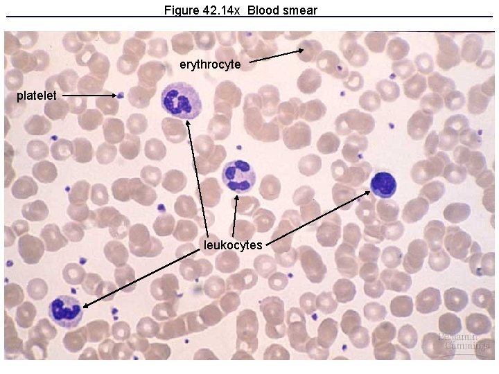 Figure 42. 14 x Blood smear erythrocyte platelet leukocytes 