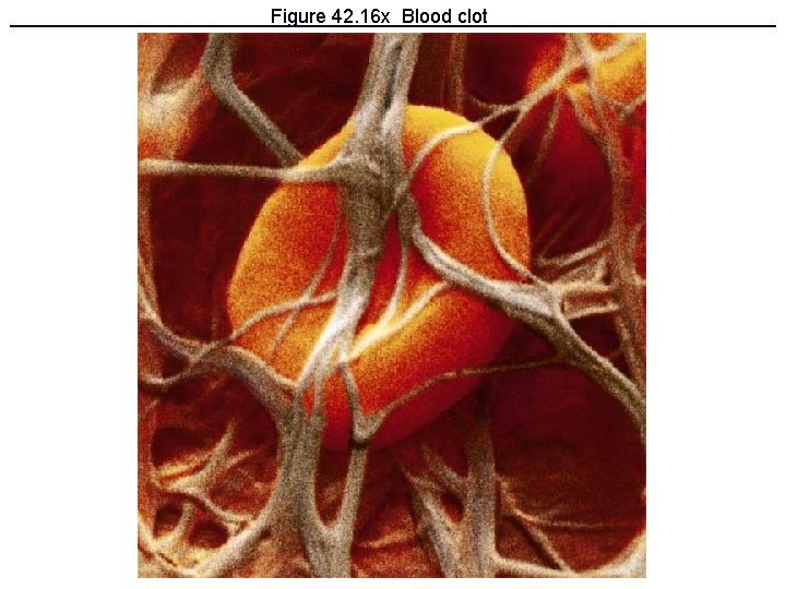 Figure 42. 16 x Blood clot 
