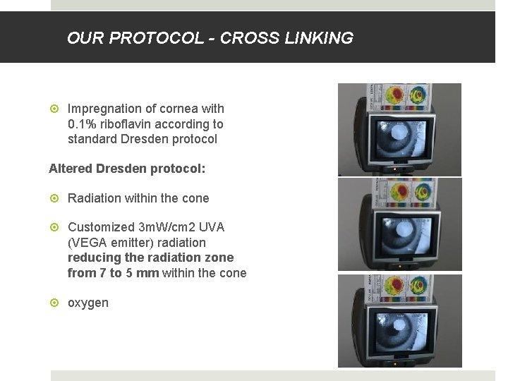 OUR PROTOCOL - CROSS LINKING Impregnation of cornea with 0. 1% riboflavin according to