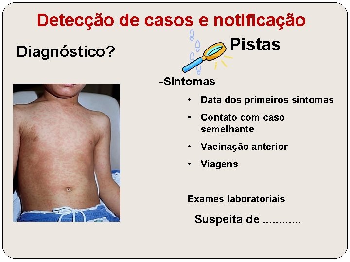 Detecção de casos e notificação Pistas Diagnóstico? -Sintomas • Data dos primeiros sintomas •