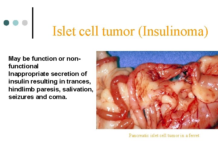 Islet cell tumor (Insulinoma) May be function or nonfunctional Inappropriate secretion of insulin resulting