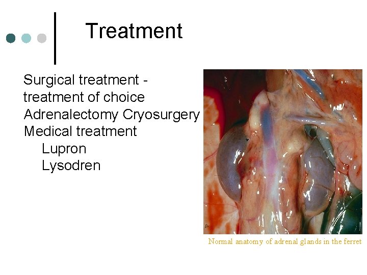 Treatment Surgical treatment of choice Adrenalectomy Cryosurgery Medical treatment Lupron Lysodren Normal anatomy of