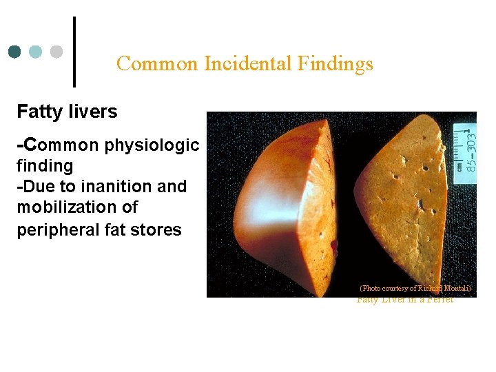 Common Incidental Findings Fatty livers -Common physiologic finding -Due to inanition and mobilization of
