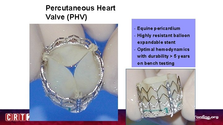 Percutaneous Heart Valve (PHV) - Equine pericardium - Highly resistant balloon expandable stent -