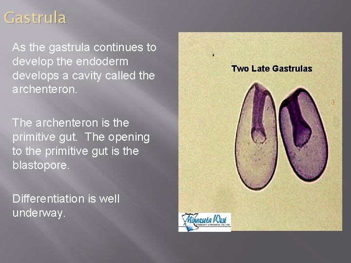 Gastrula As the gastrula continues to develop the endoderm develops a cavity called the