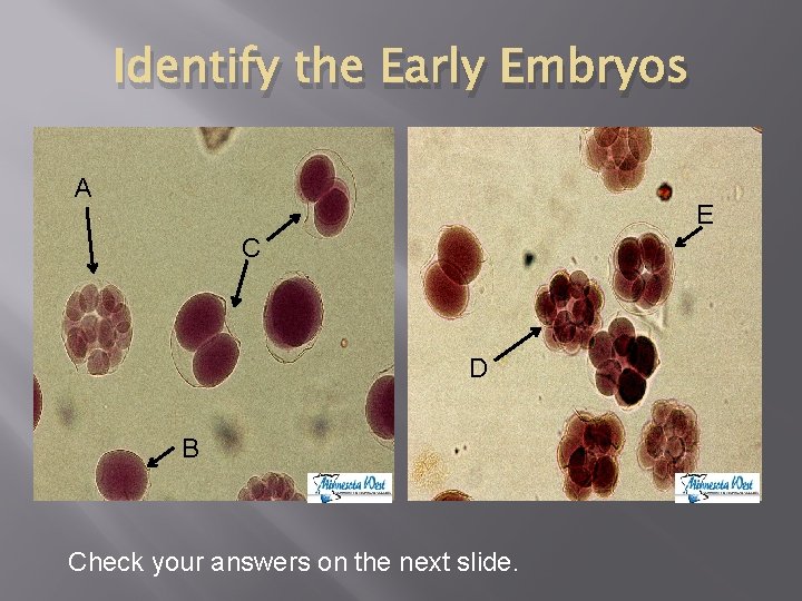 Identify the Early Embryos A E C D B Check your answers on the