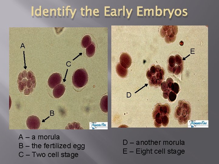 Identify the Early Embryos A E C D B A – a morula B