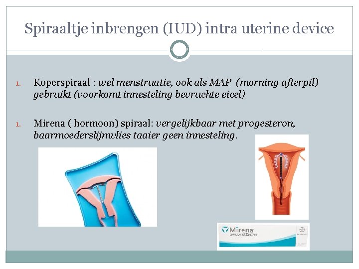 Spiraaltje inbrengen (IUD) intra uterine device 1. Koperspiraal : wel menstruatie, ook als MAP